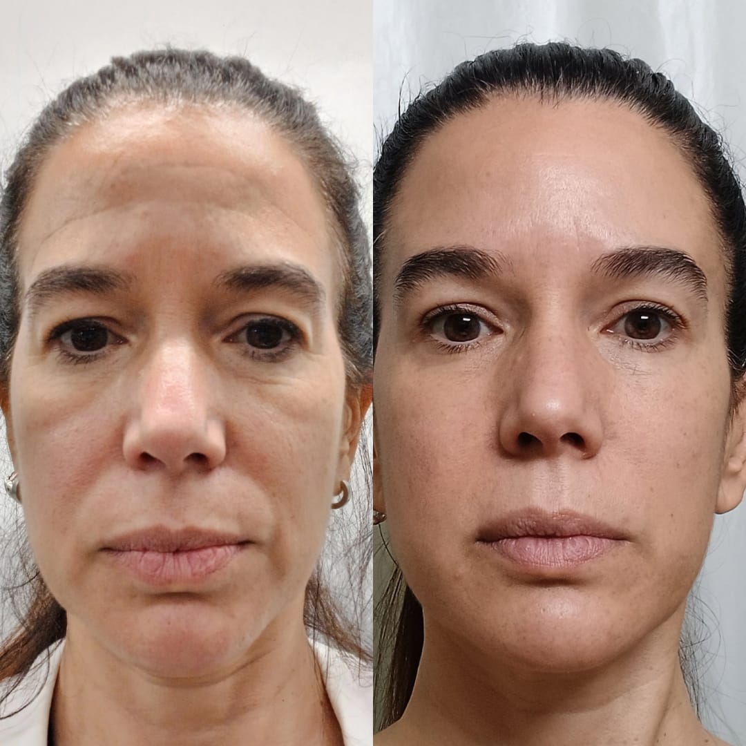 Testimonio Lift & Glow